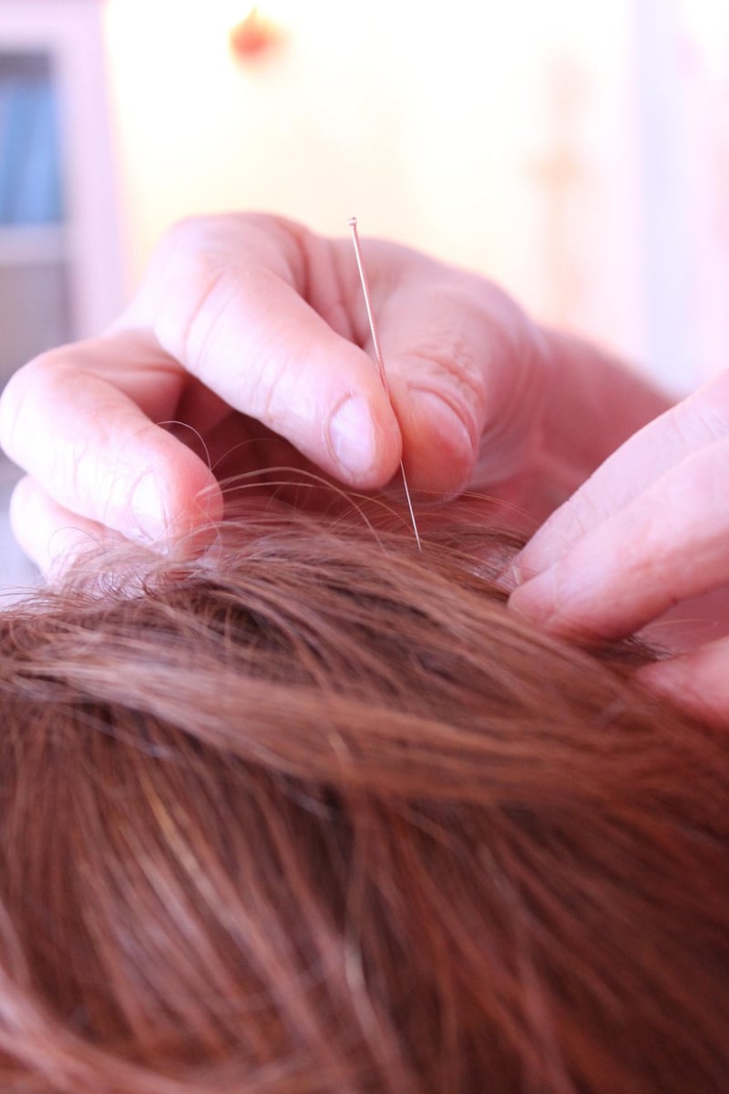 Acupuncture in Chinese medicine
